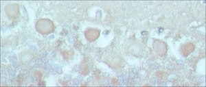 Anti-Myosin Va (LE-16) antibody produced in rabbit ~0.5 mg/mL, affinity isolated antibody, buffered aqueous solution