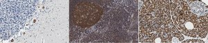 Anti-La-Related Protein 1 from rabbit, purified by affinity chromatography