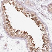Anti-GEMIN2 antibody produced in rabbit Prestige Antibodies® Powered by Atlas Antibodies, affinity isolated antibody, buffered aqueous glycerol solution