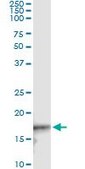 Monoclonal Anti-CDKN2D antibody produced in mouse clone 2E10, purified immunoglobulin, buffered aqueous solution