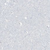 Anti-CD247 antibody produced in rabbit Prestige Antibodies® Powered by Atlas Antibodies, affinity isolated antibody, buffered aqueous glycerol solution