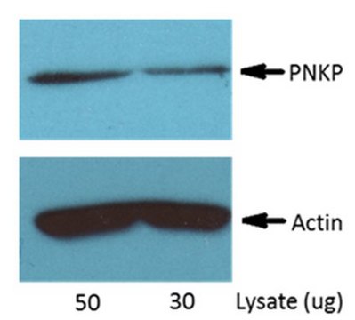 Anti-PNKP Antibody, clone H101.2 clone H101.2, from mouse