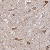 Anti-RAP1GAP antibody produced in rabbit Prestige Antibodies® Powered by Atlas Antibodies, affinity isolated antibody, buffered aqueous glycerol solution
