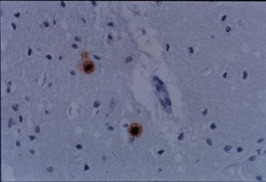 Anti-Prion Protein Antibody, NT, a.a. 78-97 serum, Chemicon&#174;