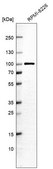 Anti-VPS51 antibody produced in rabbit Prestige Antibodies® Powered by Atlas Antibodies, affinity isolated antibody, buffered aqueous glycerol solution