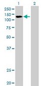 Anti-DDX42 antibody produced in mouse purified immunoglobulin, buffered aqueous solution