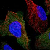 Anti-PPP3R1 antibody produced in rabbit Prestige Antibodies® Powered by Atlas Antibodies, affinity isolated antibody, buffered aqueous glycerol solution