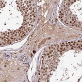 Anti-POLD1 antibody produced in rabbit Prestige Antibodies® Powered by Atlas Antibodies, affinity isolated antibody, buffered aqueous glycerol solution