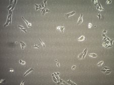 sBT-RMS Spontaneous Brain-tropic RET Melanoma-sorted Mouse Cell Line