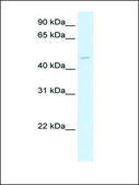 Anti-PHKG2 antibody produced in rabbit affinity isolated antibody