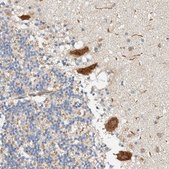 Anti-RAB11FIP1 antibody produced in rabbit Prestige Antibodies® Powered by Atlas Antibodies, affinity isolated antibody, buffered aqueous glycerol solution, Ab1