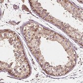 Anti-G3BP1 antibody produced in rabbit Prestige Antibodies® Powered by Atlas Antibodies, affinity isolated antibody, buffered aqueous glycerol solution