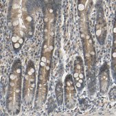 Anti-MAGI3 antibody produced in rabbit Prestige Antibodies® Powered by Atlas Antibodies, affinity isolated antibody, buffered aqueous glycerol solution