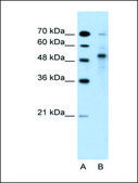 Anti-TRIM59 (AB2) antibody produced in rabbit IgG fraction of antiserum