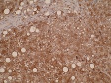 Anti-CYP7B1 Antibody, clone M17P3F2 clone M17P3F2, from mouse