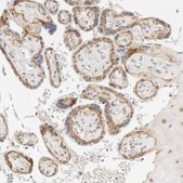 Anti-ITGA6 antibody produced in rabbit Prestige Antibodies® Powered by Atlas Antibodies, affinity isolated antibody, buffered aqueous glycerol solution