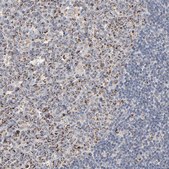 Anti-UQCRC1 antibody produced in rabbit Ab1, Prestige Antibodies® Powered by Atlas Antibodies, affinity isolated antibody, buffered aqueous glycerol solution