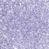 Anti-RDH16 antibody produced in rabbit Prestige Antibodies® Powered by Atlas Antibodies, affinity isolated antibody, buffered aqueous glycerol solution