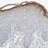 Anti-SERPINB7 antibody produced in rabbit Prestige Antibodies® Powered by Atlas Antibodies, affinity isolated antibody, buffered aqueous glycerol solution