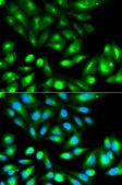 Anti-RHOC antibody produced in rabbit