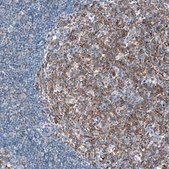 Anti-IGF2BP3 antibody produced in rabbit Prestige Antibodies® Powered by Atlas Antibodies, affinity isolated antibody, buffered aqueous glycerol solution