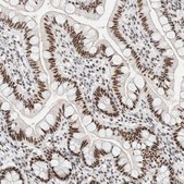 Anti-SON antibody produced in rabbit Prestige Antibodies® Powered by Atlas Antibodies, affinity isolated antibody, buffered aqueous glycerol solution