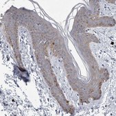 Anti-FAM83H antibody produced in rabbit Prestige Antibodies® Powered by Atlas Antibodies, affinity isolated antibody, buffered aqueous glycerol solution, Ab1
