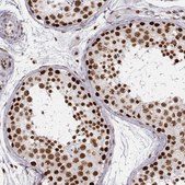 Monoclonal Anti-PARP1 antibody produced in mouse Prestige Antibodies® Powered by Atlas Antibodies, clone CL2220, purified immunoglobulin, buffered aqueous glycerol solution