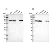 Anti-LPP antibody produced in rabbit Prestige Antibodies® Powered by Atlas Antibodies, affinity isolated antibody, buffered aqueous glycerol solution