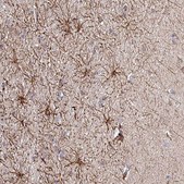 Anti-DNAL1 antibody produced in rabbit Prestige Antibodies® Powered by Atlas Antibodies, affinity isolated antibody, buffered aqueous glycerol solution