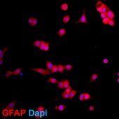 N2A Psen1/Psen2 Double Knockout Mouse Neuroblastoma Cell Line