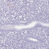 Anti-MAGEC2 antibody produced in rabbit Prestige Antibodies® Powered by Atlas Antibodies, affinity isolated antibody, buffered aqueous glycerol solution