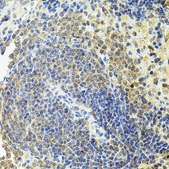 Anti-RALBP1 antibody produced in rabbit