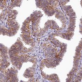 Anti-ATP2B4 antibody produced in rabbit Prestige Antibodies® Powered by Atlas Antibodies, affinity isolated antibody, buffered aqueous glycerol solution