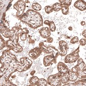 Anti-TRIM21 antibody produced in rabbit Prestige Antibodies® Powered by Atlas Antibodies, affinity isolated antibody, buffered aqueous glycerol solution