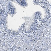 Anti-SLCO2B1 antibody produced in rabbit Prestige Antibodies® Powered by Atlas Antibodies, affinity isolated antibody, buffered aqueous glycerol solution
