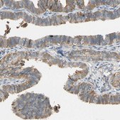 Anti-LIMK2 antibody produced in rabbit Prestige Antibodies® Powered by Atlas Antibodies, affinity isolated antibody, buffered aqueous glycerol solution