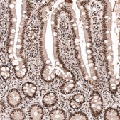 Anti-SETD2 antibody produced in rabbit Prestige Antibodies® Powered by Atlas Antibodies, affinity isolated antibody, buffered aqueous glycerol solution