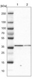 Anti-SCAMP2 antibody produced in rabbit Prestige Antibodies® Powered by Atlas Antibodies, affinity isolated antibody, buffered aqueous glycerol solution