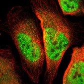 Anti-TSHZ1 antibody produced in rabbit Prestige Antibodies® Powered by Atlas Antibodies, affinity isolated antibody, buffered aqueous glycerol solution