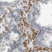 Anti-PANX1 antibody produced in rabbit Prestige Antibodies® Powered by Atlas Antibodies, affinity isolated antibody, buffered aqueous glycerol solution