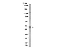 Anti-Ferrochelatase serum, from rabbit