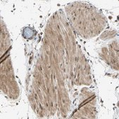 Anti-TRIO antibody produced in rabbit Prestige Antibodies® Powered by Atlas Antibodies, affinity isolated antibody, buffered aqueous glycerol solution