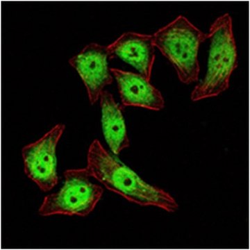 Anti-KLF4 Antibody, clone 1E6 ascites fluid, clone 1E06, from mouse