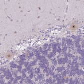 Anti-MAK16 antibody produced in rabbit Prestige Antibodies® Powered by Atlas Antibodies, affinity isolated antibody, buffered aqueous glycerol solution
