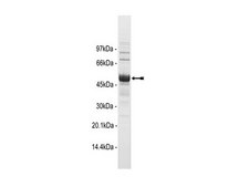 Met (Y1248C) Protein, active, 10 µg Active, N-terminal 6His-tagged, recombinant, human, Met amino acids 974-end, containing the mutation Y1248C. For use in Kinase Assays.