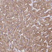 Anti-PC antibody produced in rabbit Prestige Antibodies® Powered by Atlas Antibodies, affinity isolated antibody, buffered aqueous glycerol solution