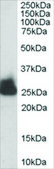 Anti-Triosephosphate Isomerase antibody produced in goat affinity isolated antibody, buffered aqueous solution