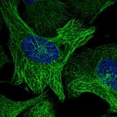 Anti-NUDT6 antibody produced in rabbit Prestige Antibodies® Powered by Atlas Antibodies, affinity isolated antibody, buffered aqueous glycerol solution