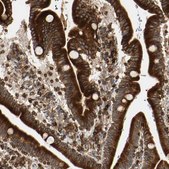 Anti-TAPBP antibody produced in rabbit Prestige Antibodies® Powered by Atlas Antibodies, affinity isolated antibody, buffered aqueous glycerol solution